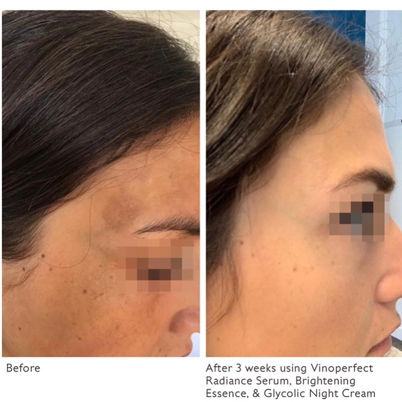 5/$15 😍 Caudalie Vinoperfect Radiance Serum Complexion Correcting Sample Size💙 - Picture 3 of 8